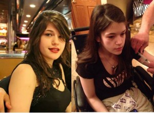 Morgan before:after