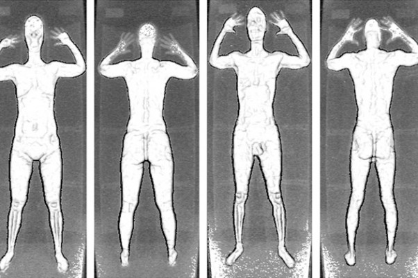 Filtered images from a backscatter body scanner. (Photo by TSA)